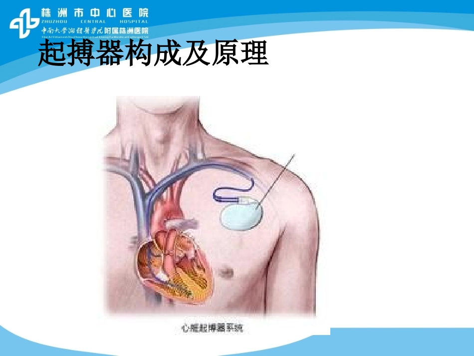 永久型起搏器术后运动康复_第3页