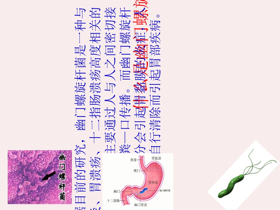 幽门螺旋杆菌抗体阳性怎么办_第2页