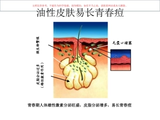 油性皮肤和痤疮课件