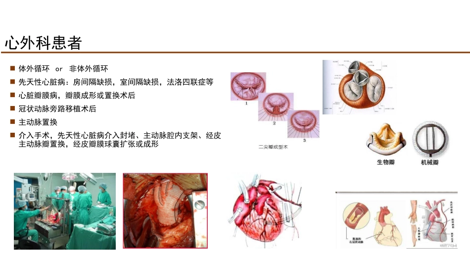 右美托咪啶在心外科应用_第2页