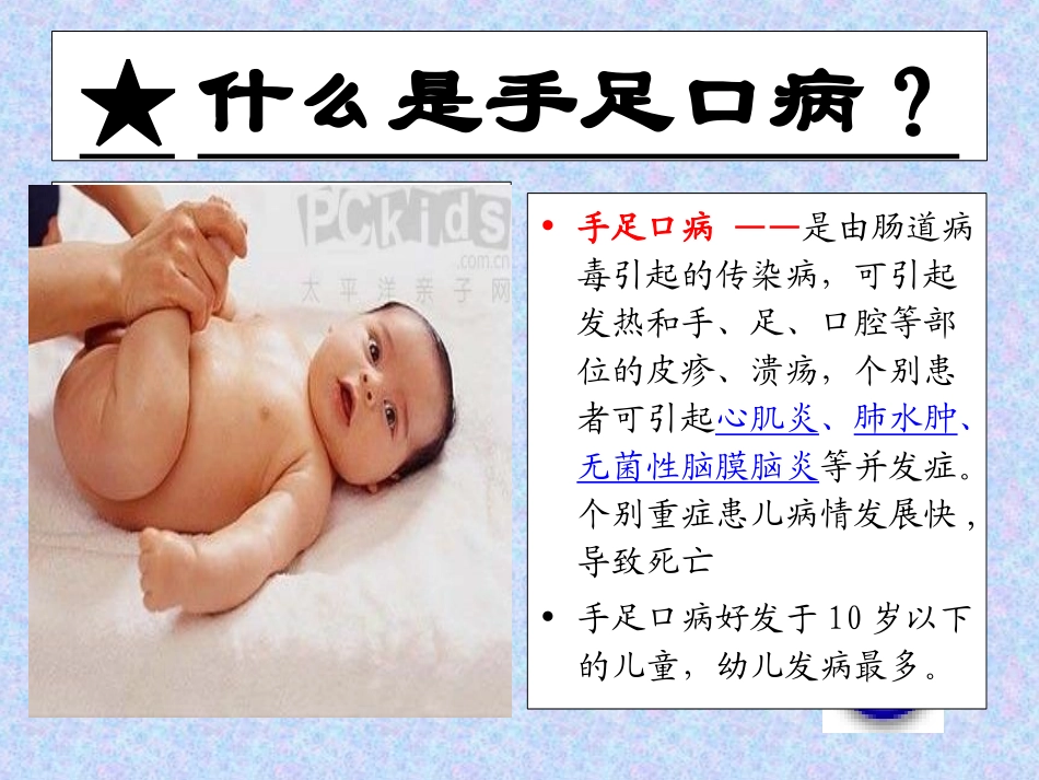 预防手足口病主题班会_第2页