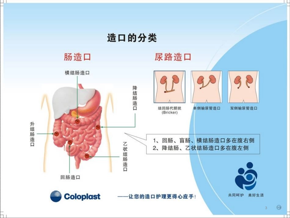 造瘘口的护理_第3页