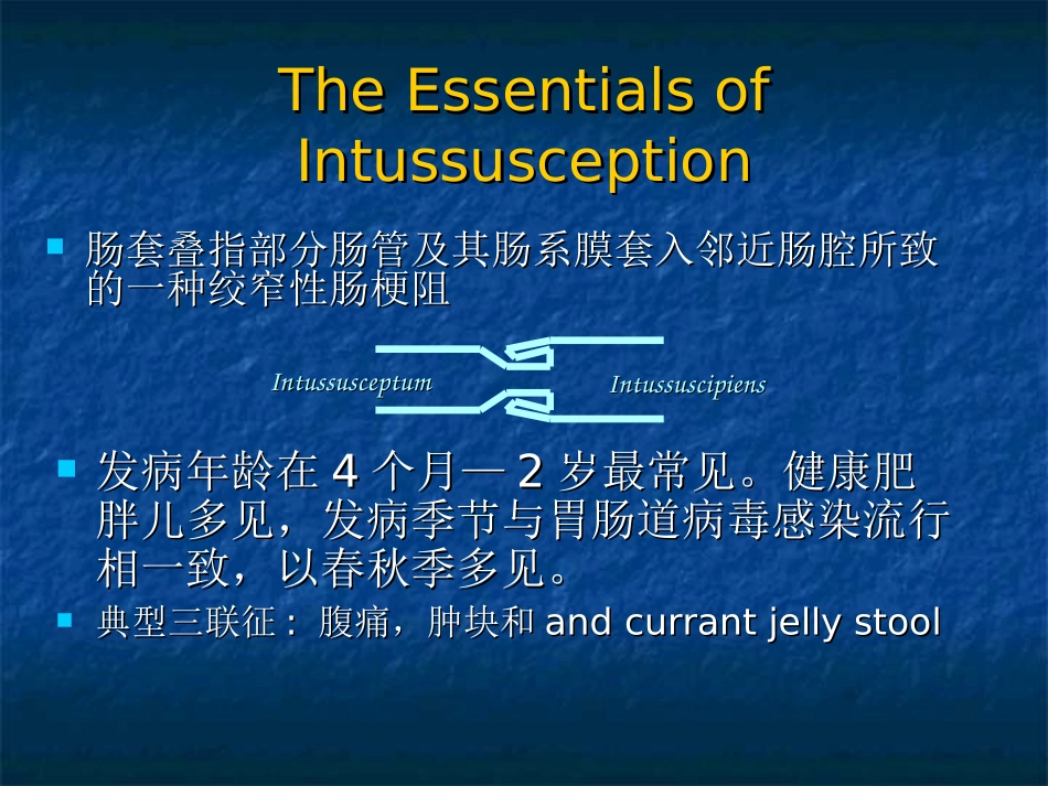 肠套叠影像诊疗讲义_第2页