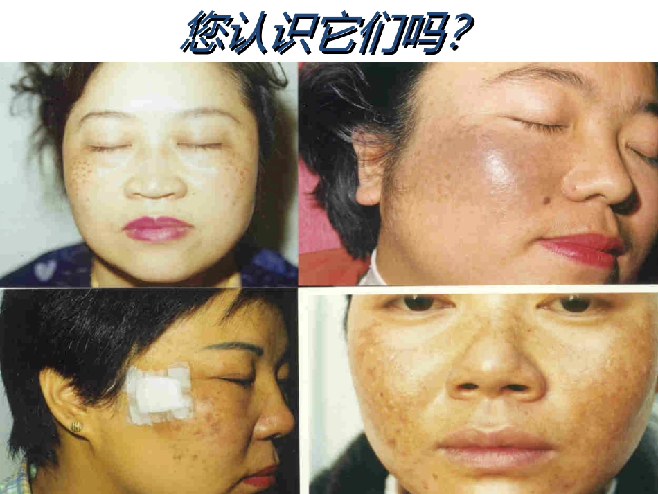 常见损容性皮肤疾病讲义_第2页