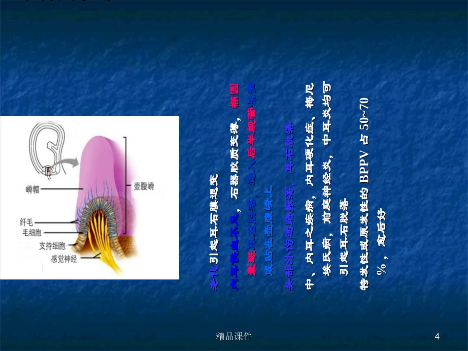 常见眩晕疾病课件_第3页
