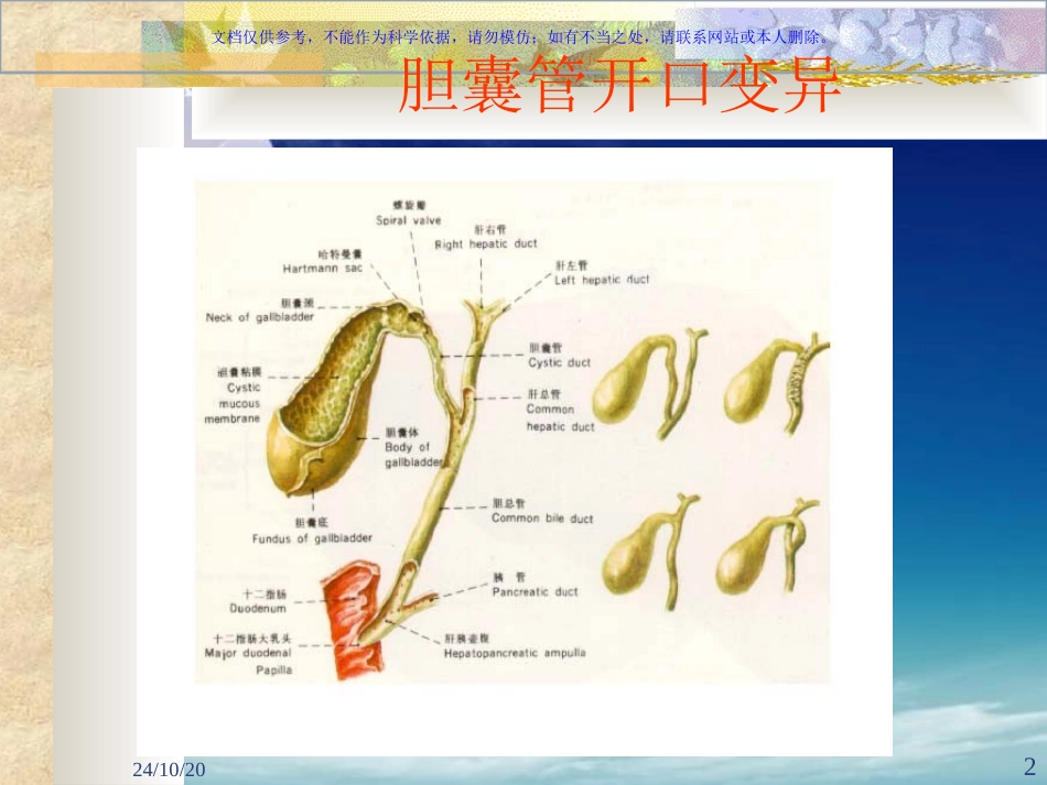 胆囊结石伴胆囊炎课件_第2页