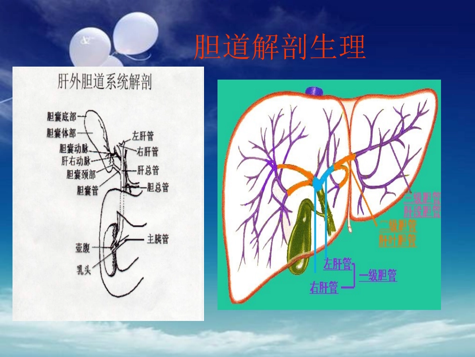 胆囊结石伴胆囊炎培训课件_第2页