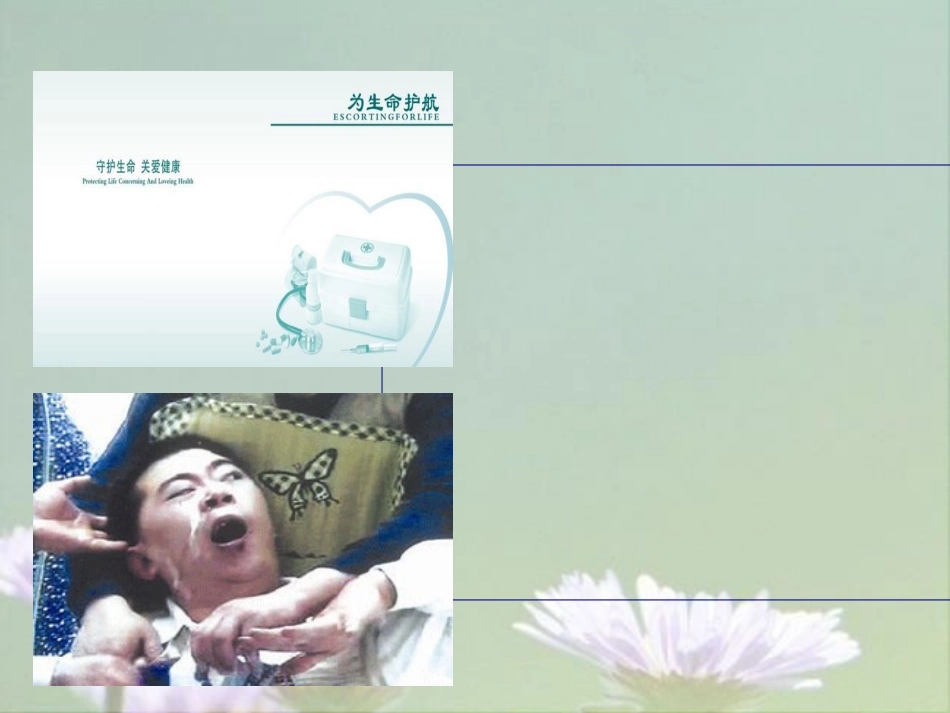 癫痫的表现和急救处置优质课件_第2页