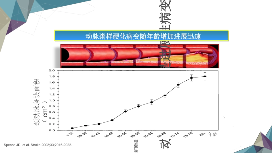 动脉粥样硬化的发生机制_第3页