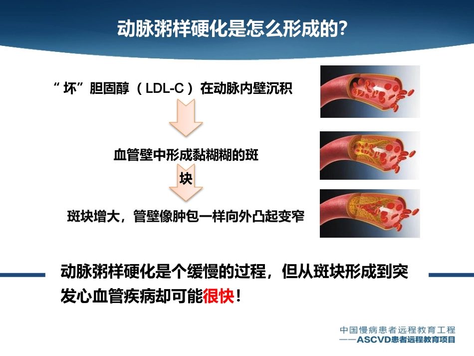 动脉粥样硬化会导致哪些疾病_第3页