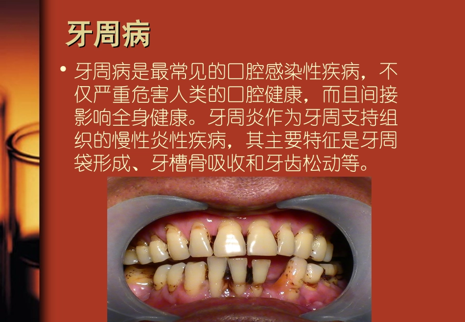 读书报告牙周病_第2页