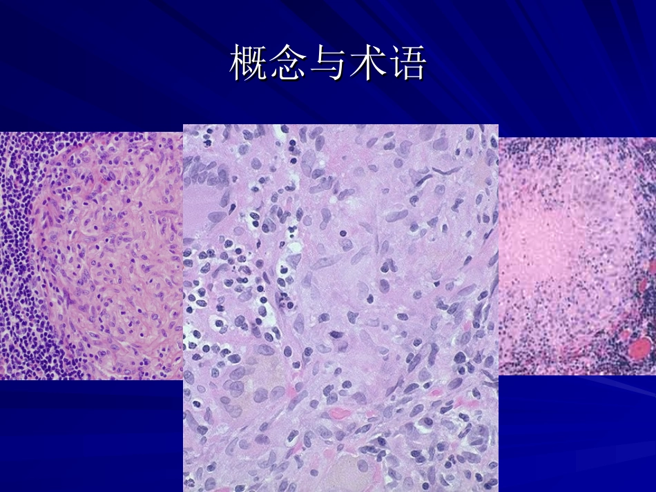 肺肉芽肿疾病优质课件_第2页