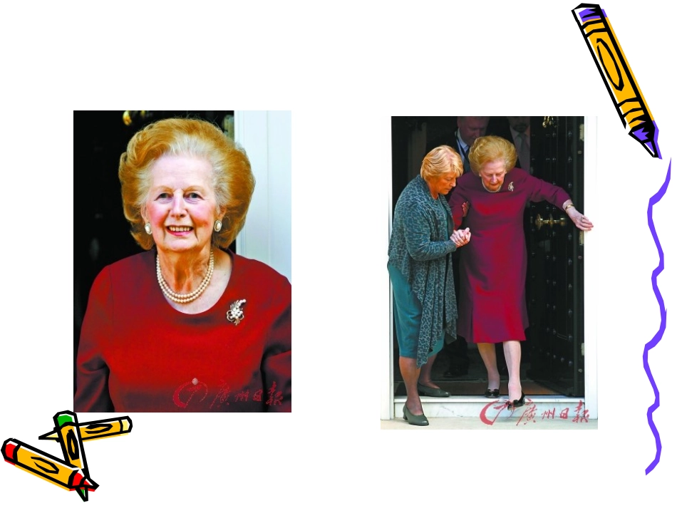 风湿性多肌痛_第2页