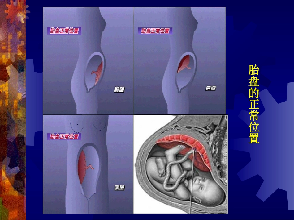 妇产科学精品课件前置胎盘_第2页