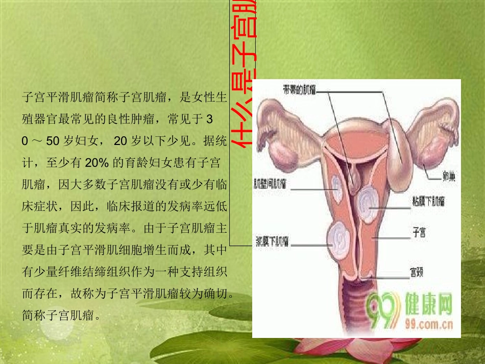 妇科护理查房._第2页