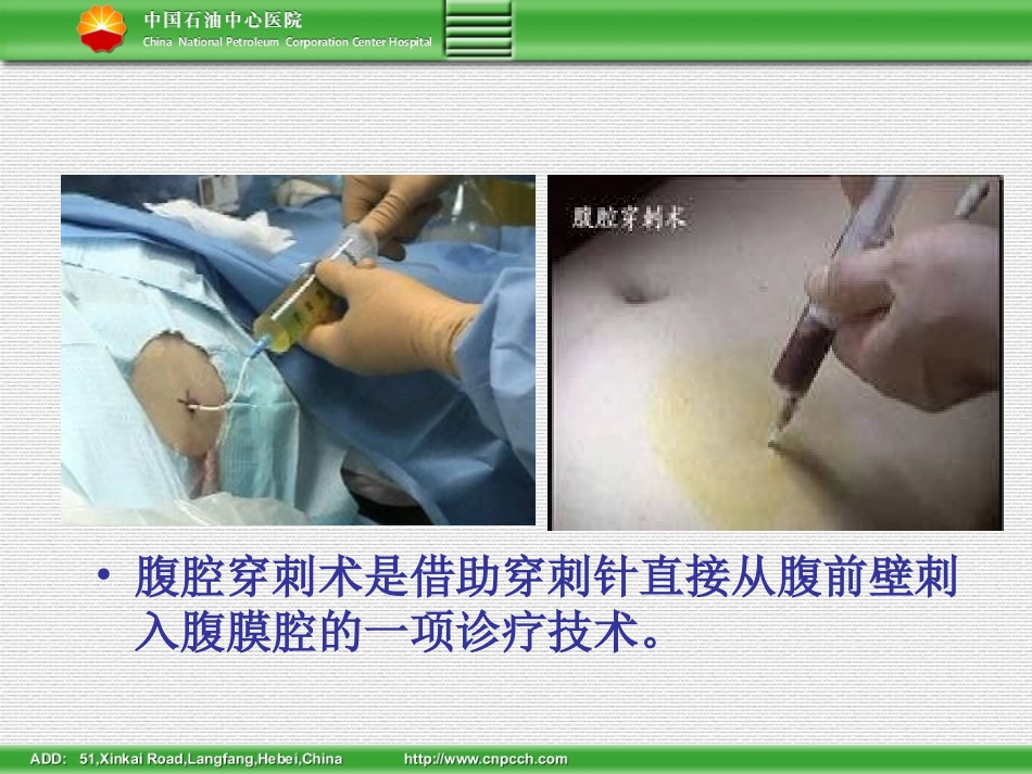腹穿培训课件_第2页