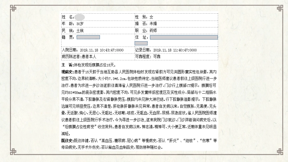 腹膜后神经鞘瘤_第2页