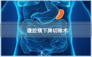 腹腔镜下脾切除术