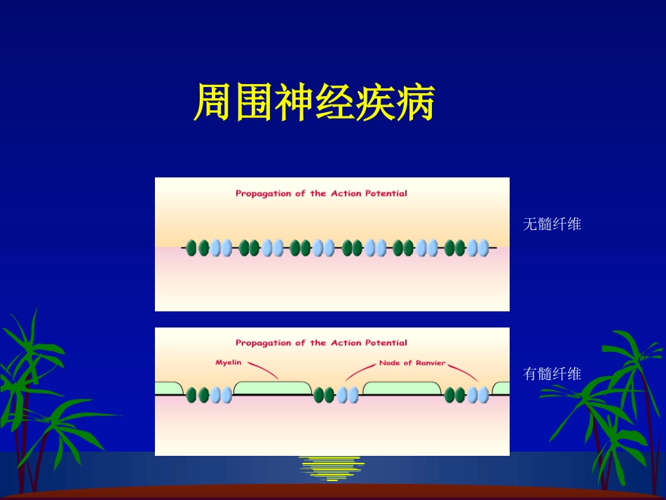 格林巴利综合征_第1页