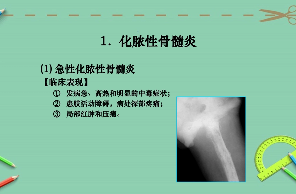 骨结核及化脓性骨髓炎影像诊断_第3页