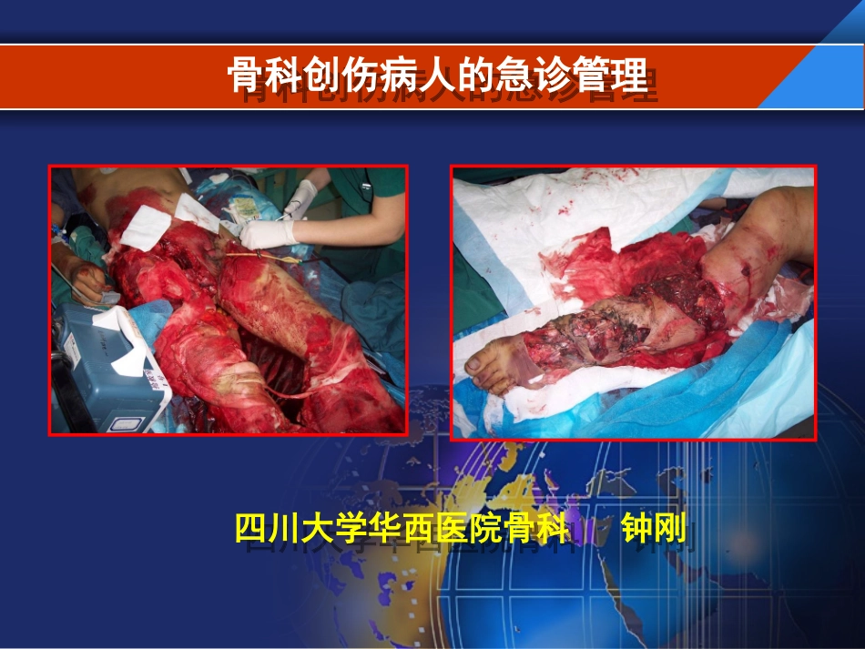 骨科创伤病人的创伤管理_第1页