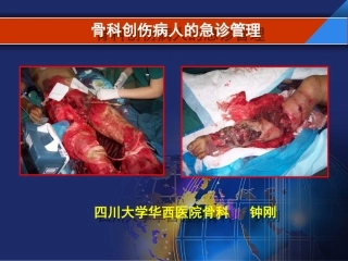 骨科创伤病人的创伤管理