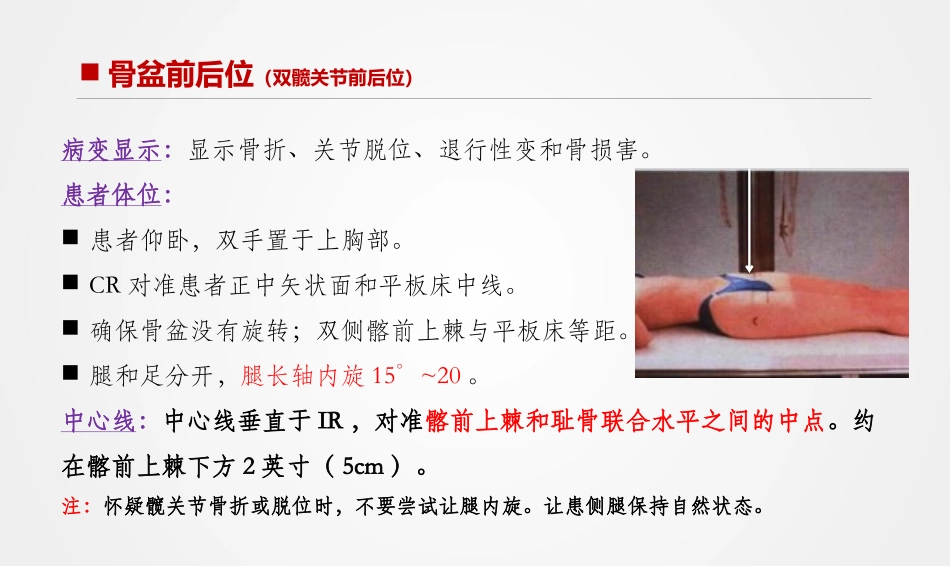 骨盆与髋关节X线摄影技术_第2页