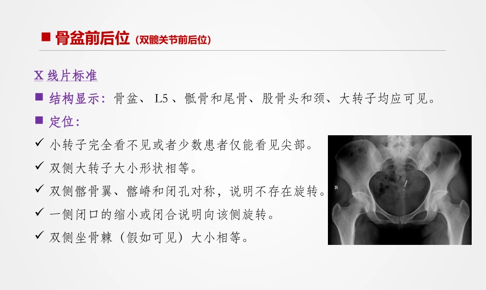 骨盆与髋关节X线摄影技术_第3页