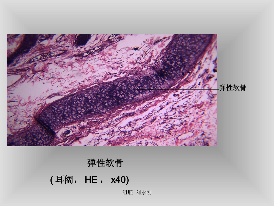 骨软骨和骨发生切片_第2页