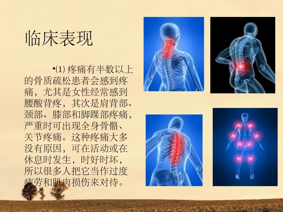 骨质疏松健康教育讲座_第3页