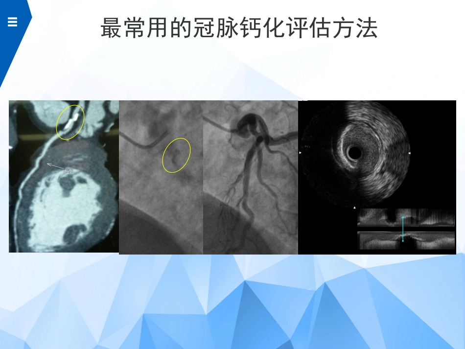 冠状动脉钙化无创评估和造影评估_第3页