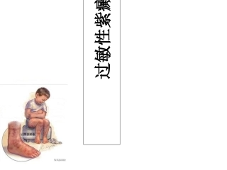 过敏性紫癜课件
