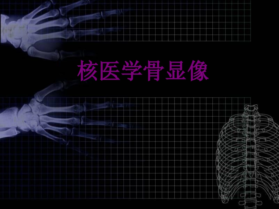 核医学骨显像优质课件_第1页