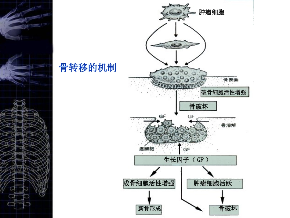 核医学骨显像优质课件_第3页