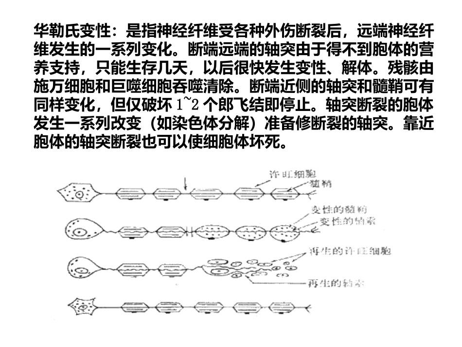 华勒氏变性影像学表现_第2页