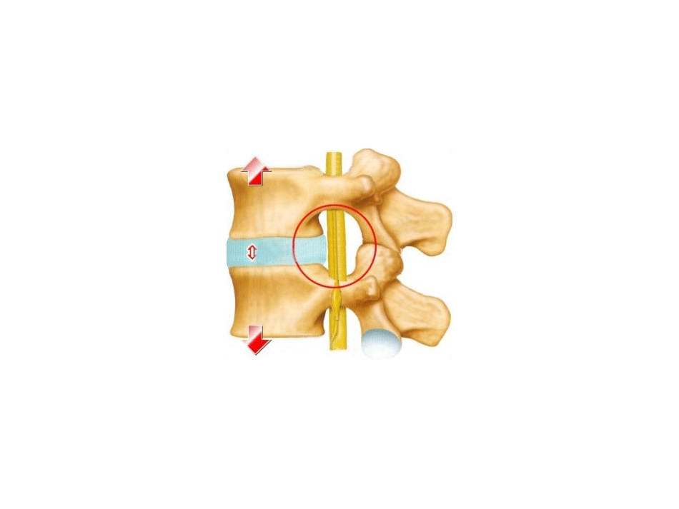 脊柱微创手术简介优质课件_第3页