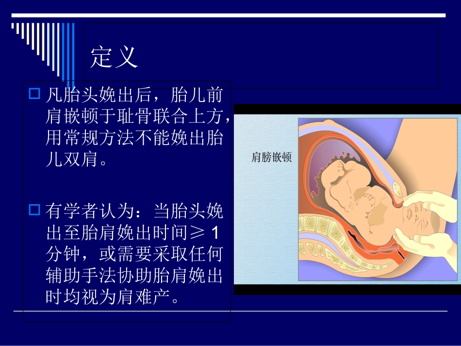 肩难产的紧急处置培训课件_第3页