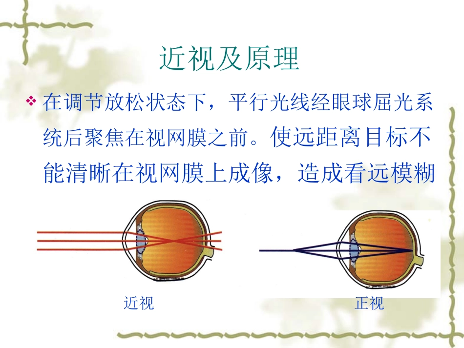 角膜塑形镜宣传_第3页