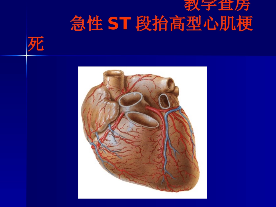 教学查房急性心肌梗死_第1页