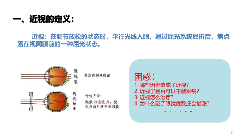 近视处方原则_第3页