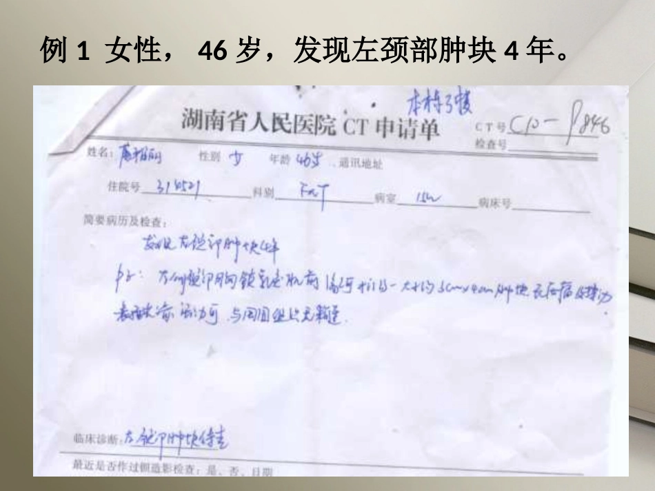 颈部神经鞘瘤_第1页