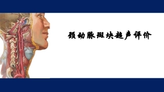 颈动脉斑块超声评价