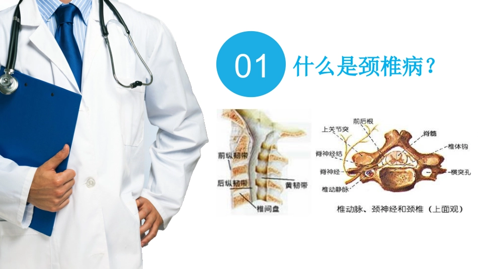 颈椎病的防治_第3页