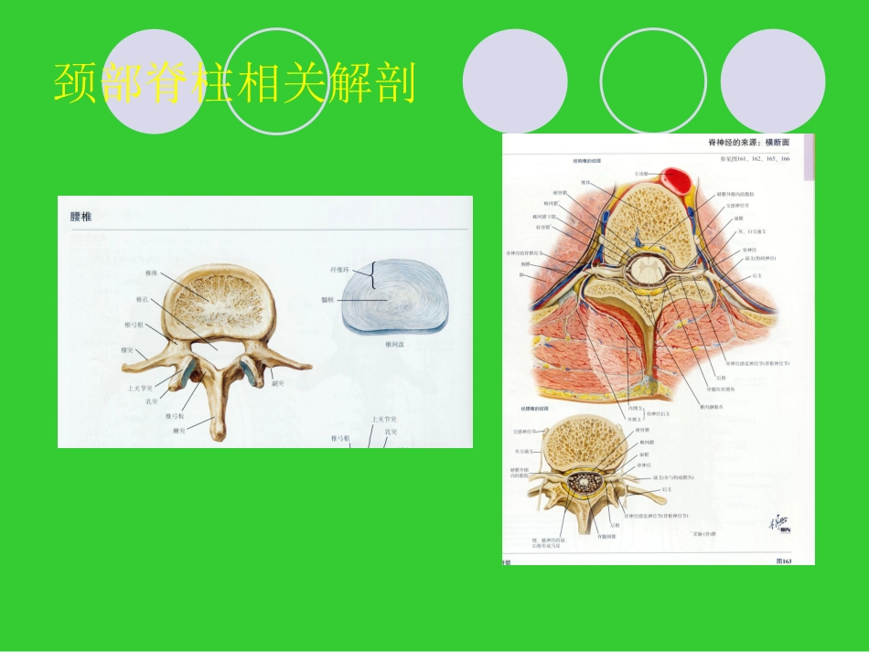 颈椎病的分型及诊治_第3页