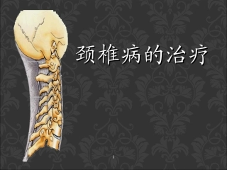 颈椎病优质课件