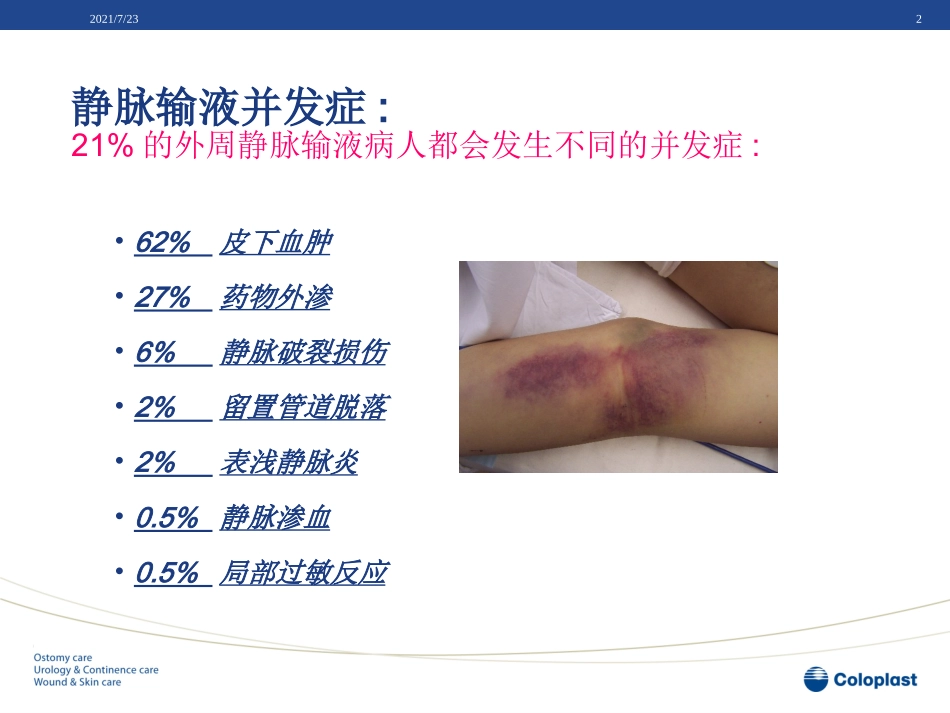静脉炎的预防和处理_第2页