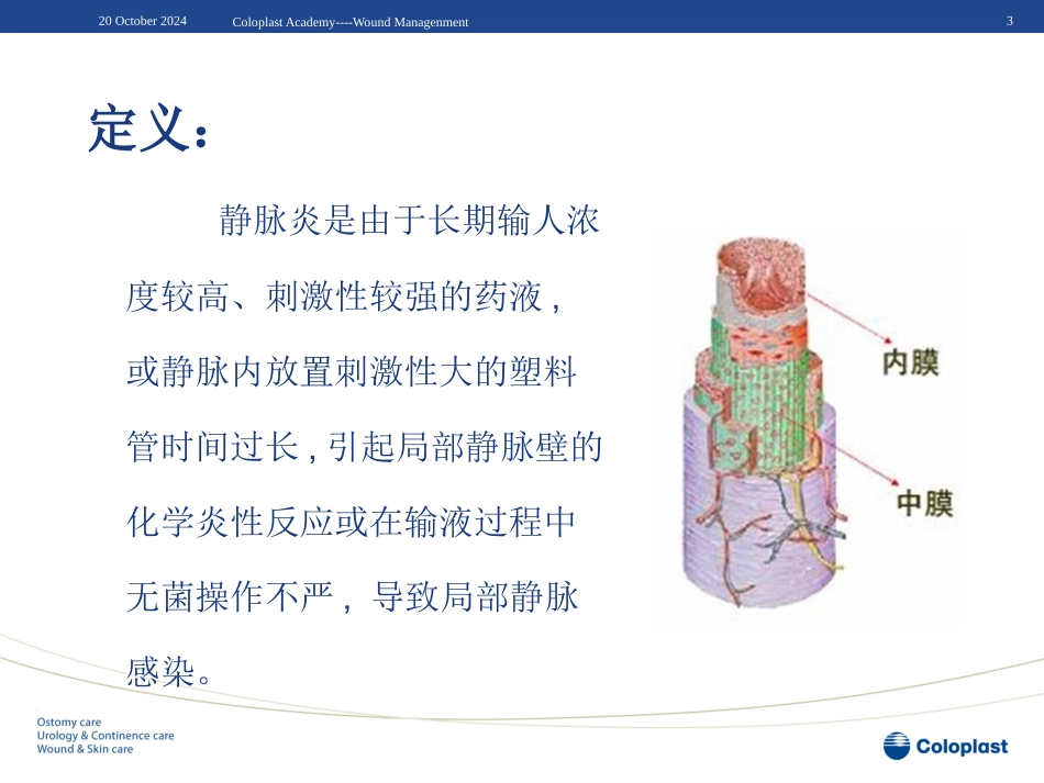 静脉炎的预防和处置_第3页