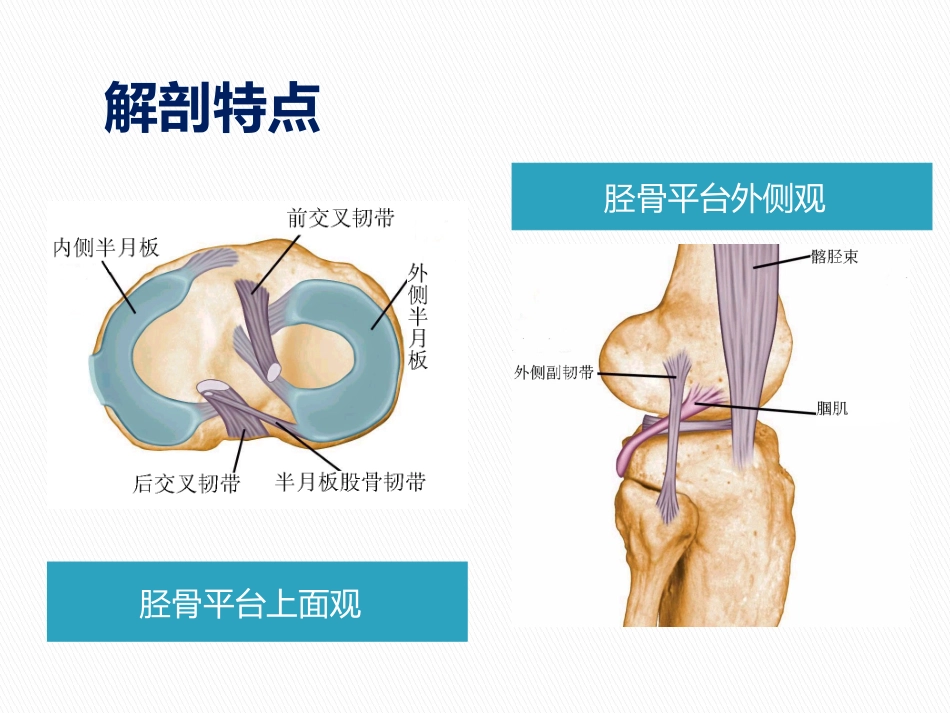 康复科教学查房胫骨平台骨折_第2页