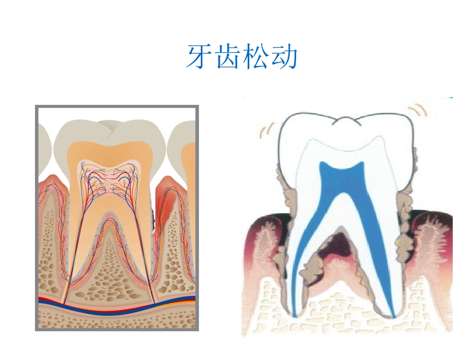 口腔常见疾病科普_第3页