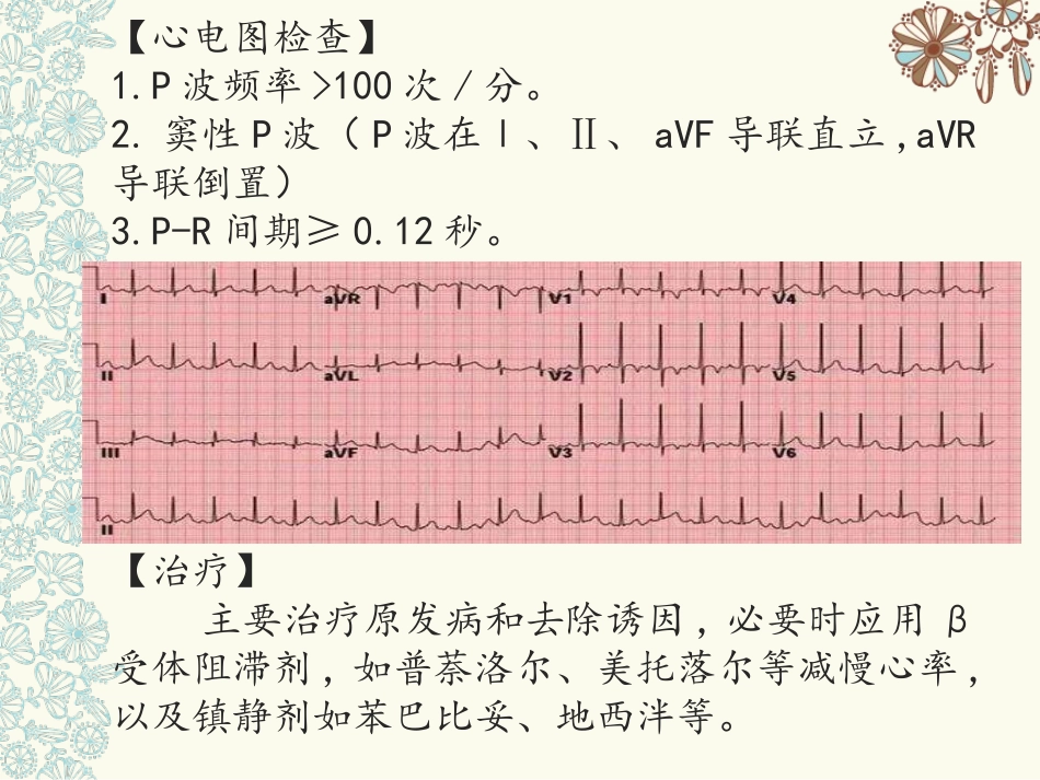 快速性心律失常_第3页